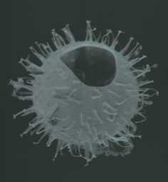 Operculodinum