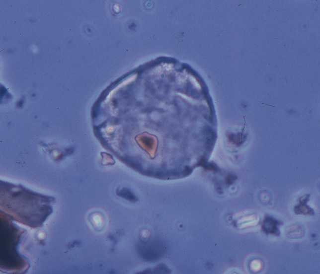 Engelhardtia