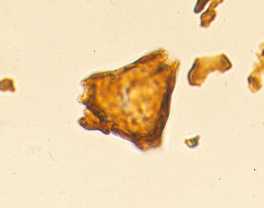 Proteacidites
